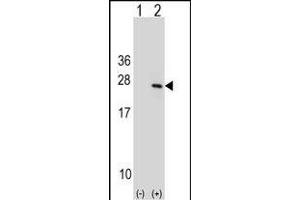 Western blot analysis of PTP4A1 (arrow) using rabbit polyclonal PTP4A1 Antibody (C-term) (ABIN1536716 and ABIN2848589). (PTP4A1 Antikörper  (C-Term))