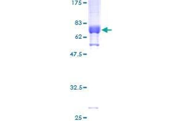 SPDEF/PSE Protein (AA 1-335) (GST tag)