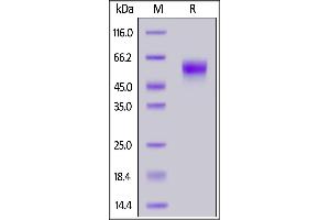 SDS-PAGE (SDS) image for Interleukin 2 Receptor, gamma (IL2RG) (AA 23-254) protein (His tag) (ABIN6992411)