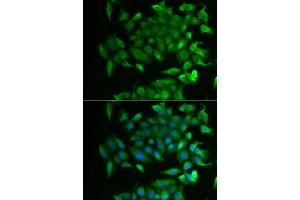 Immunofluorescence analysis of MCF-7 cell using RBP2 antibody. (RBP2 Antikörper)