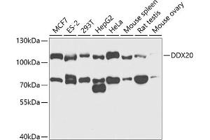 Western blot analysis of extracts of various cell lines, using DDX20 antibody (ABIN6130250, ABIN6139482, ABIN6139483 and ABIN6221507) at 1:1000 dilution. (DDX20 Antikörper  (AA 25-280))