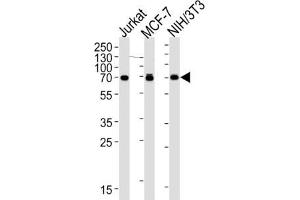 Western Blotting (WB) image for anti-Ribosomal Protein S6 Kinase, 70kDa, Polypeptide 2 (RPS6KB2) antibody (ABIN2995324) (RPS6KB2 Antikörper)