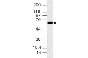 Image no. 1 for anti-Cytochrome P450, Family 1, Subfamily B, Polypeptide 1 (CYP1B1) (AA 1-260) antibody (ABIN5027128) (CYP1B1 Antikörper  (AA 1-260))