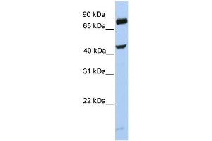 WB Suggested Anti-SMYD3 Antibody Titration:  0. (SMYD3 Antikörper  (C-Term))