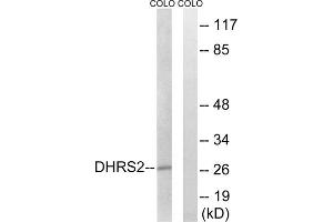 Western blot analysis of extracts from COLO cells, using DHRS2 antibody. (DHRS2 Antikörper  (Internal Region))
