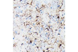 Immunohistochemistry of paraffin-embedded mouse brain using GFAP Rabbit mAb (ABIN7267389) at dilution of 1:100 (40x lens). (GFAP Antikörper)