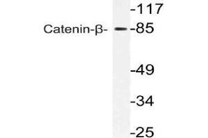Western blot (WB) analysis of Catenin-beta antibody in extracts from 293 cells. (CTNNB1 Antikörper)