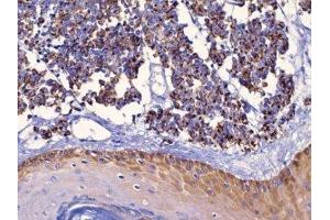 Immunohistochemistry (IHC) image for anti-Keratin 18 (KRT18) (C-Term) antibody (ABIN870569) (Cytokeratin 18 Antikörper  (C-Term))