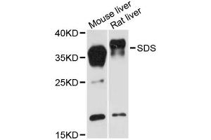 Western blot analysis of extracts of various cell lines, using SDS antibody (ABIN6293759) at 1:3000 dilution. (serine Dehydratase Antikörper)