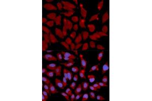 Immunofluorescence analysis of U2OS cell using DNMT3A antibody. (DNMT3A Antikörper  (AA 500-700))