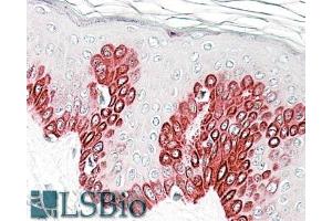 Immunohistochemistry (IHC) image for anti-Sirtuin 1 (SIRT1) (AA 577-590) antibody (ABIN625834)