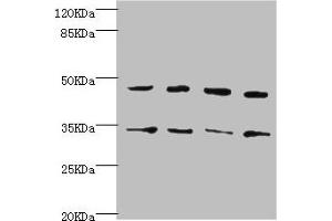 Western blot All lanes: CYTH2 antibody at 5. (Cytohesin 2 Antikörper  (AA 150-350))