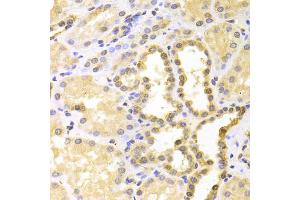 Immunohistochemistry of paraffin-embedded human kidney using S100A11 antibody (ABIN5973196) at dilution of 1/100 (40x lens). (S100A11 Antikörper)