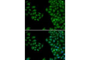 Immunofluorescence (IF) image for anti-Neurofilament, Light Polypeptide (NEFL) (AA 400-543) antibody (ABIN6213733) (NEFL Antikörper  (AA 400-543))