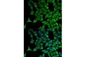 Immunofluorescence (IF) image for anti-Keratin 20 (KRT20) (AA 245-424) antibody (ABIN3020782)