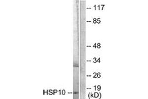 Western blot analysis of extracts from NIH-3T3 cells, using HSP10 Antibody. (HSPE1 Antikörper  (AA 51-100))