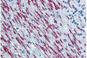 Human Brain, Cerebellum: Formalin-Fixed, Paraffin-Embedded (FFPE)