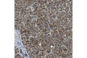 Immunohistochemical staining of human liver with APOBEC4 polyclonal antibody  shows strong granular positivity in hepatocytes. (APOBEC4 Antikörper)