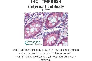 Image no. 2 for anti-Transmembrane Protease, serine 4 (TMPRSS4) (Internal Region) antibody (ABIN1740176) (TMPRSS4 Antikörper  (Internal Region))