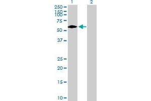 Western Blot analysis of DTX2 expression in transfected 293T cell line by DTX2 MaxPab polyclonal antibody. (DTX2 Antikörper  (AA 1-622))