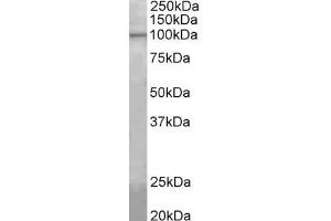 Western Blotting (WB) image for anti-ATP/GTP Binding Protein-Like 5 (AGBL5) (AA 137-149) antibody (ABIN1099865) (AGBL5 Antikörper  (AA 137-149))