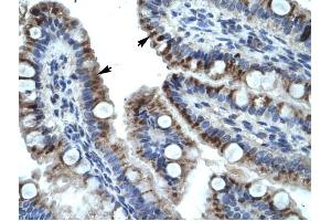 KRT15 antibody was used for immunohistochemistry at a concentration of 4-8 ug/ml to stain Epithelial cells of intestinal villus (arrows) in Human Intestine. (KRT15 Antikörper  (C-Term))