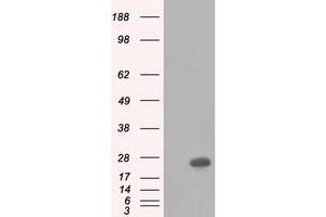 HEK293T cells were transfected with the pCMV6-ENTRY control (Left lane) or pCMV6-ENTRY BDH2 (Right lane) cDNA for 48 hrs and lysed. (BDH2 Antikörper)
