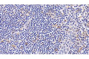 Detection of Bcl2 in Human Amygdalitis Tissue using Monoclonal Antibody to B-Cell Leukemia/Lymphoma 2 (Bcl2) (Bcl-2 Antikörper  (AA 2-211))