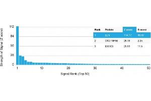 Analysis of Protein Array containing >19,000 full-length human proteins using Elastin (ELN) Mouse Monoclonal Antibody (ELN/1981) Z- and S- Score: The Z-score represents the strength of a signal that a monoclonal antibody (Monoclonal Antibody) (in combination with a fluorescently-tagged anti-IgG secondary antibody) produces when binding to a particular protein on the HuProtTM array. (Elastin Antikörper)