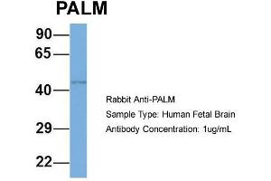Host: Rabbit  Target Name: PALM  Sample Tissue: Human Fetal Brain  Antibody Dilution: 1. (Paralemmin Antikörper  (N-Term))