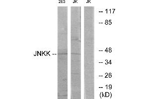 Western blot analysis of extracts from Jurkat cells and 293 cells, using JNKK antibody. (MAP2K4 Antikörper  (Internal Region))
