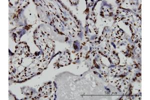 Immunoperoxidase of monoclonal antibody to TAF11 on formalin-fixed paraffin-embedded human placenta. (TAF11 Antikörper  (AA 158-210))