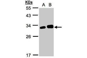 WB Image Sample(30 ug whole cell lysate) A:293T B:HeLa S3, 12% SDS PAGE antibody diluted at 1:1000