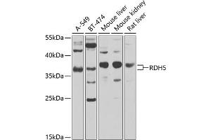 Western blot analysis of extracts of various cell lines, using RDH5 antibody (ABIN6130851, ABIN6146839, ABIN6146840 and ABIN6224076) at 1:1000 dilution. (RDH5 Antikörper  (AA 24-318))