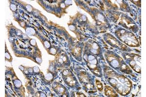 ABIN6264961 and ABIN6279698 at 1/100 staining Mouse colorectal tissue by IHC-P.