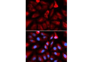 Immunofluorescence analysis of U2OS cells using FKBP4 antibody (ABIN5973289). (FKBP4 Antikörper)