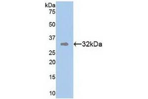 Detection of Recombinant TR1, Human using Polyclonal Antibody to Tomoregulin 1 (TR1) (TMEFF1 Antikörper  (AA 79-333))