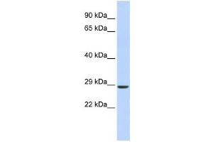 Western Blotting (WB) image for anti-SIX Homeobox 2 (SIX2) antibody (ABIN2458374) (SIX2 Antikörper)