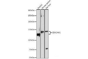 Western blot analysis of extracts of various cell lines using CEACAM1 Polyclonal Antibody at dilution of 1:1000. (CEACAM1 Antikörper)