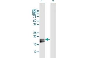 Western Blot analysis of IFNA1 expression in transfected 293T cell line by IFNA1 MaxPab polyclonal antibody. (IFNA1 Antikörper  (AA 1-189))