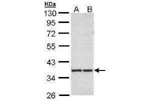 Western Blotting (WB) image for anti-Aldo-Keto Reductase Family 1, Member B10 (Aldose Reductase) (AKR1B10) antibody (ABIN2856687)
