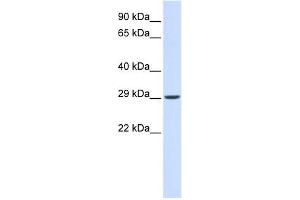 VTI1A antibody used at 1 ug/ml to detect target protein. (VTI1A Antikörper)