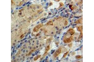 Used in DAB staining on fromalin fixed paraffin-embedded Stomach tissue (Neuromedin U Antikörper  (AA 38-174))