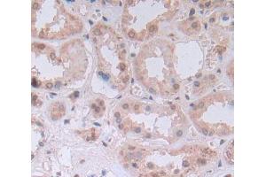 IHC-P analysis of Kidney tissue, with DAB staining. (UMPS Antikörper  (AA 205-480))