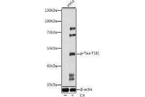 Western blot analysis of extracts of HeLa cells, using Phospho-Tau-T181 antibody (ABIN7268528) at 1:1000 dilution. (MAPT Antikörper  (pThr181))