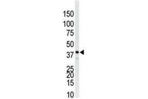 p38 antibody used in western blot to detect p38 in Jurkat cell lysate