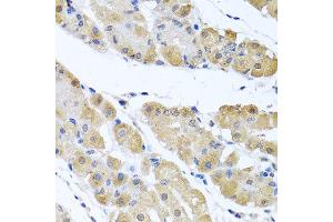 Immunohistochemistry of paraffin-embedded human gastric using OGFR antibody at dilution of 1:100 (x40 lens).