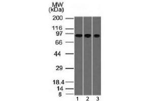 Western blot testing of human 1) A549, 2) HepG2 and 3) HCT-116 cell lysate with Villin antibody (clone VIL1/1314). (Villin 1 Antikörper  (AA 179-311))
