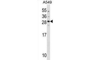 Western Blotting (WB) image for anti-Guanylate Cyclase Activator 1B (Retina) (GUCA1B) antibody (ABIN3000950)