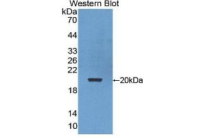 Figure. (POMP Antikörper  (AA 1-141))